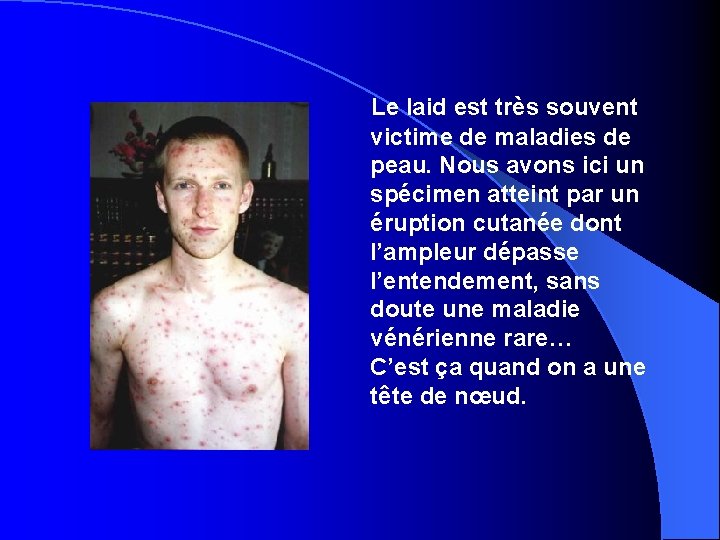 Le laid est très souvent victime de maladies de peau. Nous avons ici un