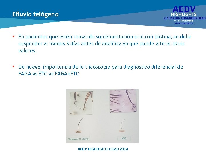 Efluvio telógeno • En pacientes que estén tomando suplementación oral con biotina, se debe