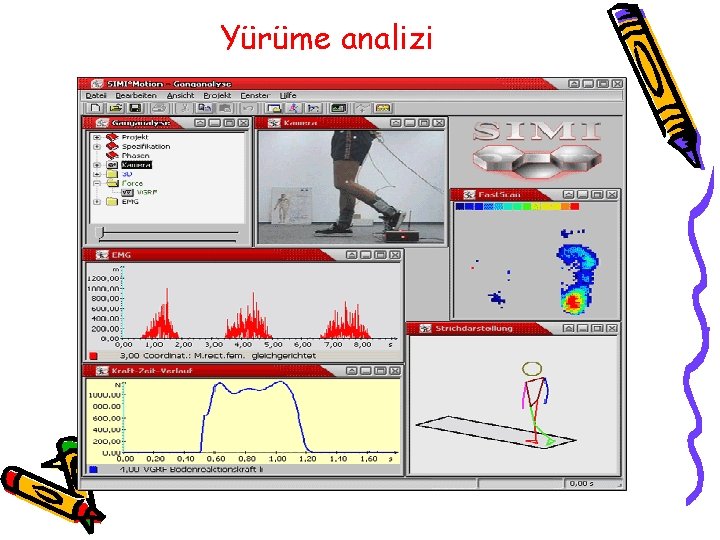 Yürüme analizi Yürüme analizi