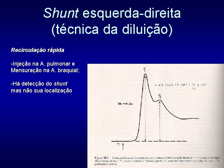 Shunt esquerda-direita (técnica da diluição) Recirculação rápida -Injeção na A. pulmonar e Mensuração na