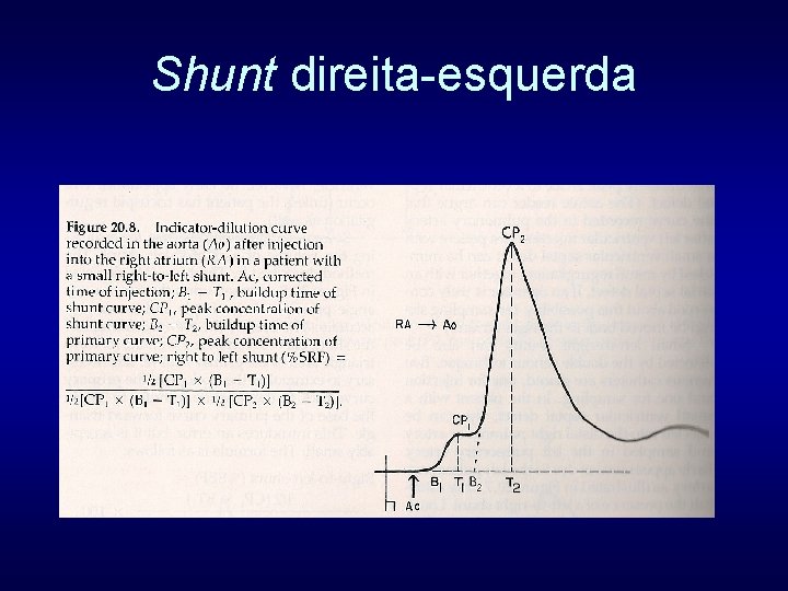 Shunt direita-esquerda 