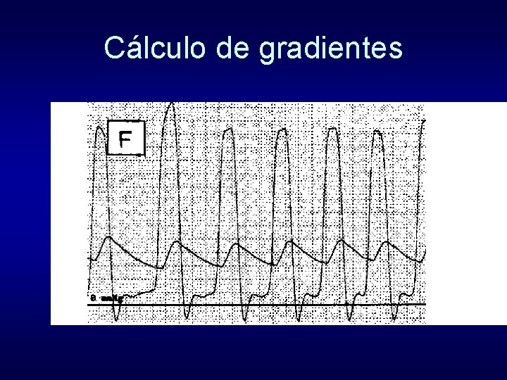 Cálculo de gradientes Cálculo de gradientes