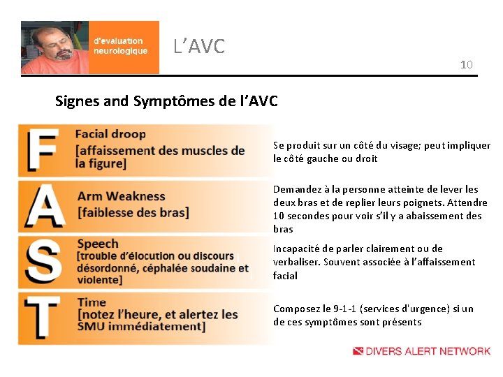 L’AVC 10 Signes and Symptômes de l’AVC Se produit sur un côté du visage;