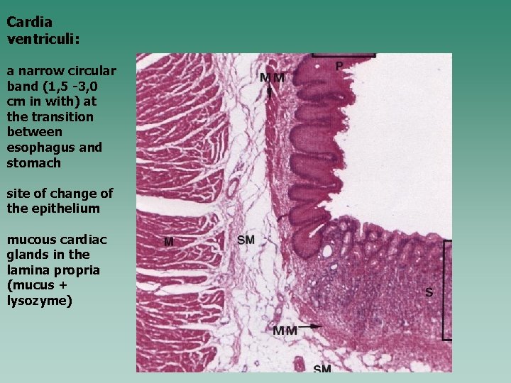 Cardia ventriculi: a narrow circular band (1, 5 -3, 0 cm in with) at