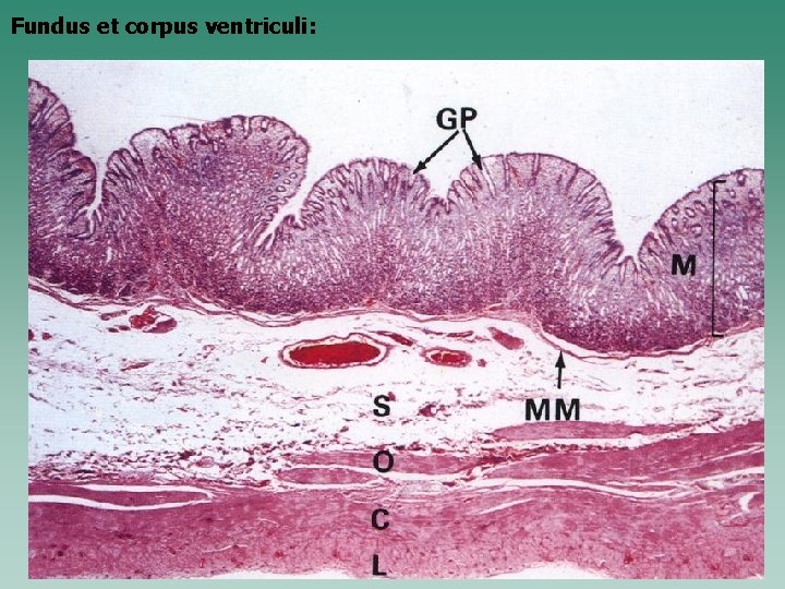 Fundus et corpus ventriculi: 