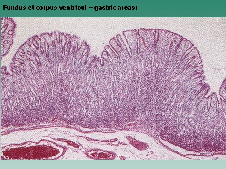 Fundus et corpus ventricul – gastric areas: 