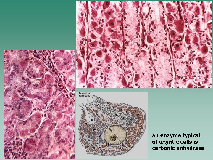 an enzyme typical of oxyntic cells is carbonic anhydrase 