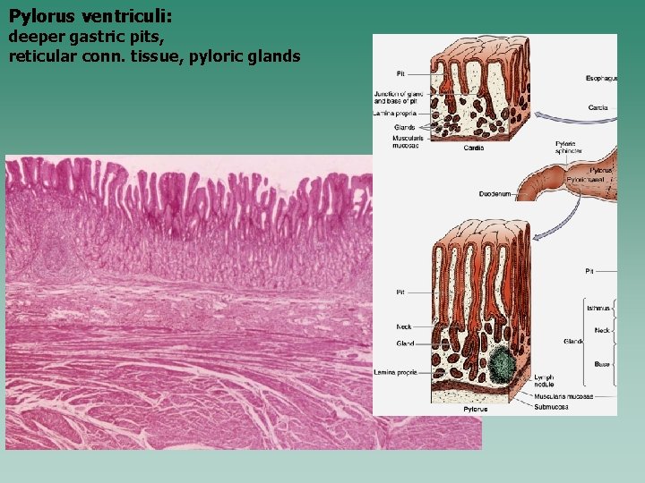 Pylorus ventriculi: deeper gastric pits, reticular conn. tissue, pyloric glands 