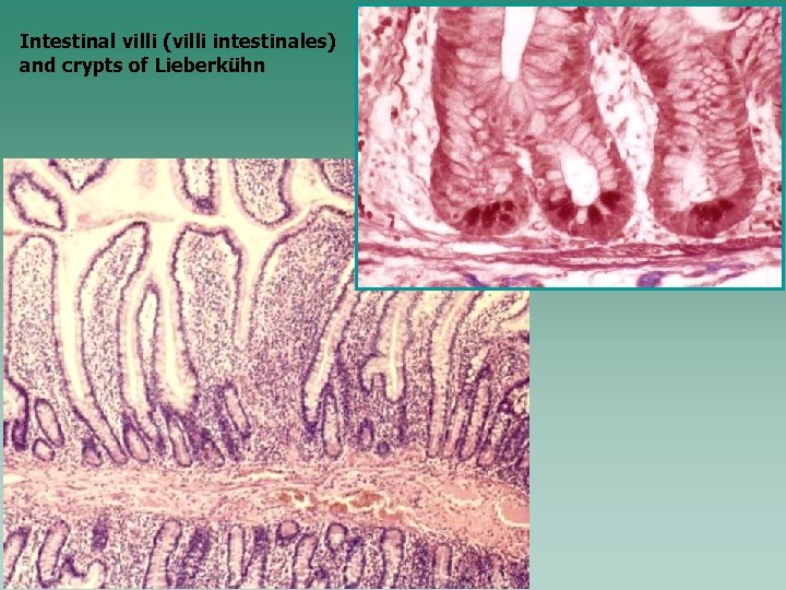 Intestinal villi (villi intestinales) and crypts of Lieberkühn 