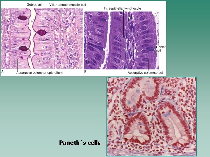 Paneth´s cells 