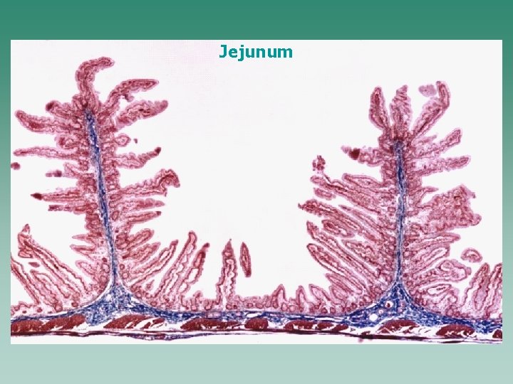 Jejunum 