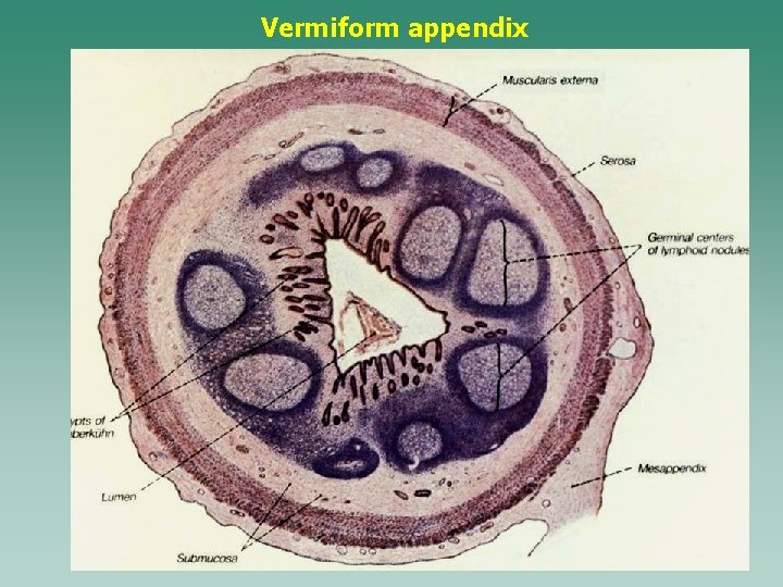 Vermiform appendix 