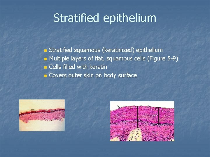 Stratified epithelium n n Stratified squamous (keratinized) epithelium Multiple layers of flat, squamous cells Stratified epithelium n n Stratified squamous (keratinized) epithelium Multiple layers of flat, squamous cells
