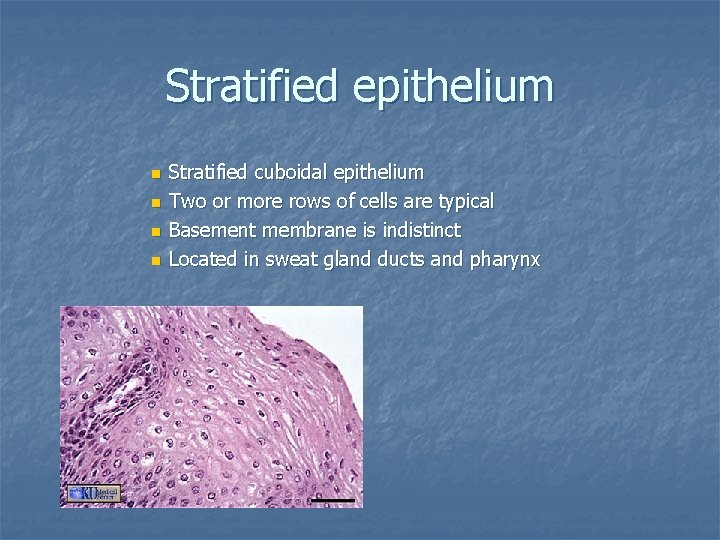 Stratified epithelium n n Stratified cuboidal epithelium Two or more rows of cells are