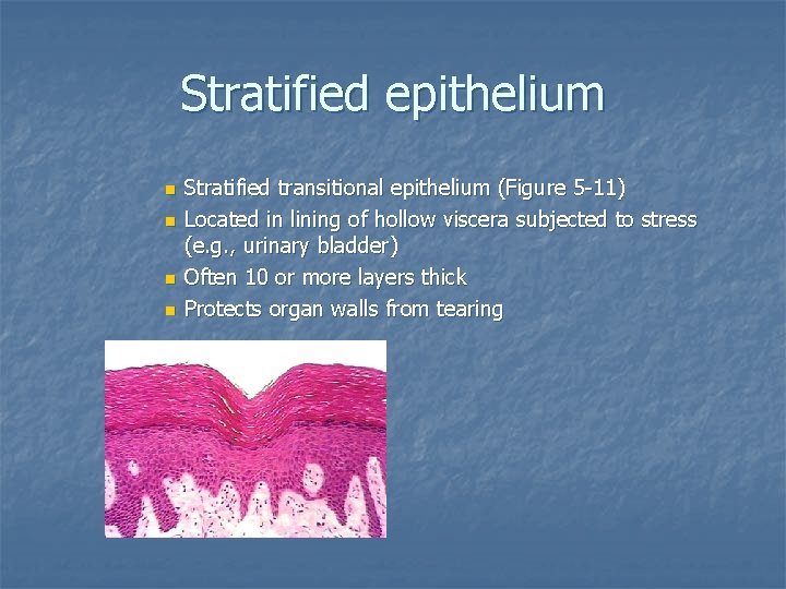 Stratified epithelium n n Stratified transitional epithelium (Figure 5 -11) Located in lining of