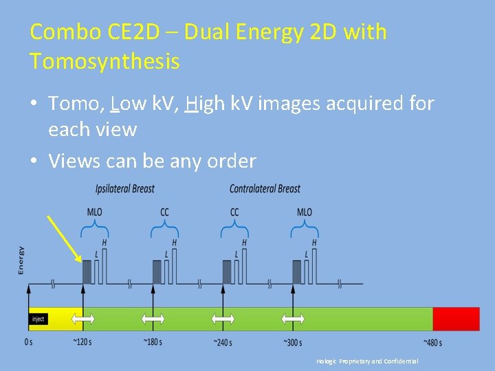 Combo CE 2 D – Dual Energy 2 D with Tomosynthesis • Tomo, Low
