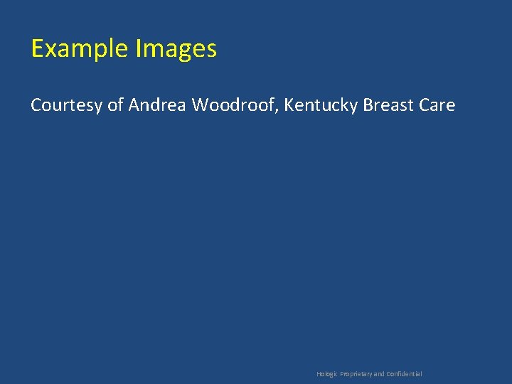 Example Images Courtesy of Andrea Woodroof, Kentucky Breast Care Hologic Proprietary and Confidential 