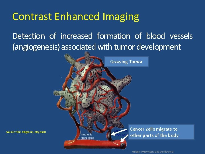 Contrast Enhanced Imaging Detection of increased formation of blood vessels (angiogenesis) associated with tumor