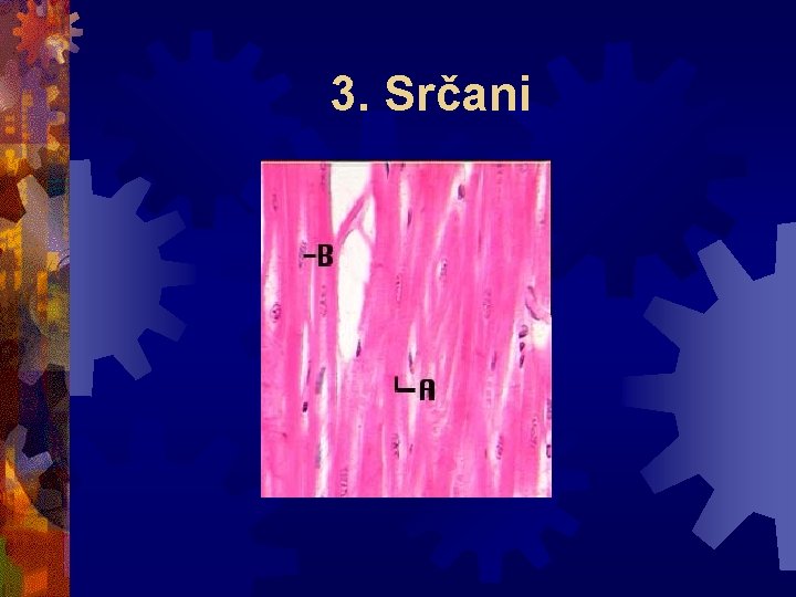 3. Srčani 