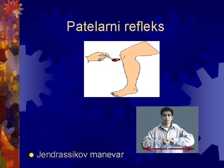 Patelarni refleks ® Jendrassikov manevar 