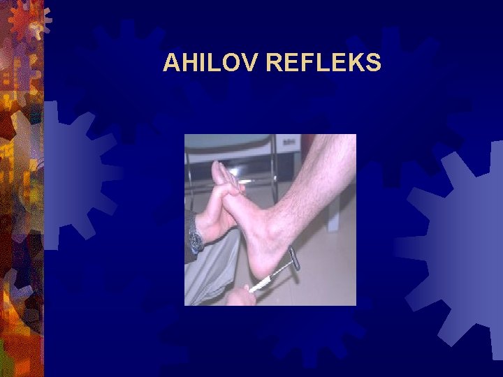AHILOV REFLEKS 