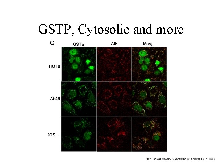 GSTP, Cytosolic and more 