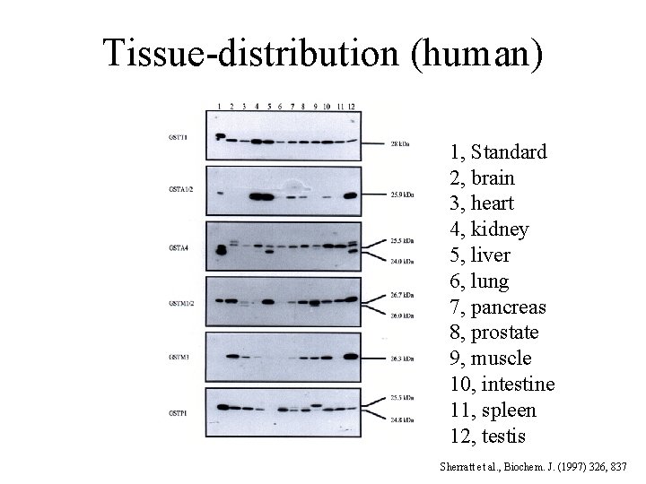 Tissue-distribution (human) 1, Standard 2, brain 3, heart 4, kidney 5, liver 6, lung