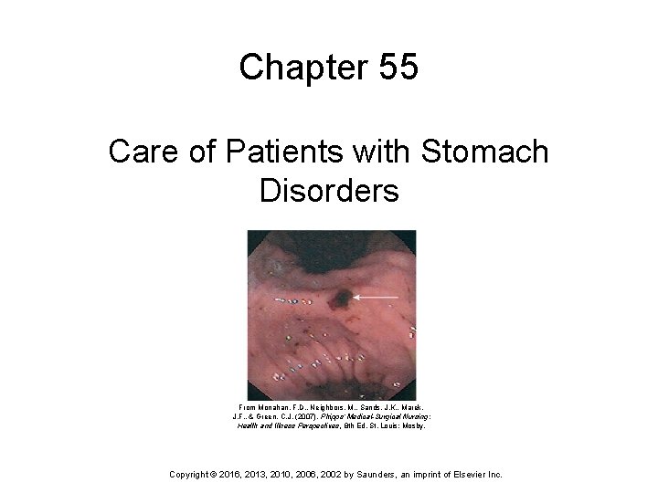 Chapter 55 Care of Patients with Stomach Disorders From Monahan, F. D. , Neighbors,