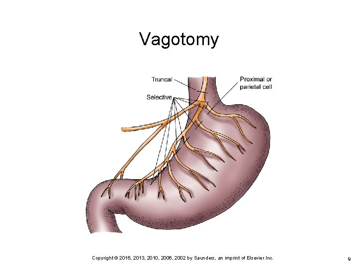 Vagotomy 9 Copyright © 2016, 2013, 2010, 2006, 2002 by Saunders, an imprint of