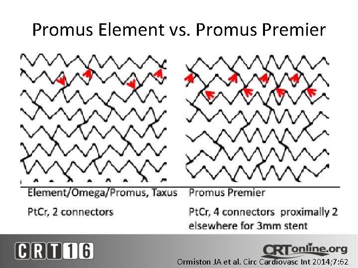 Promus Element vs. Promus Premier Ormiston JA et al. Circ Cardiovasc Int 2014; 7:
