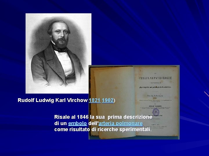 Rudolf Ludwig Karl Virchow 1821 1902) 1902 Risale al 1846 la sua prima descrizione