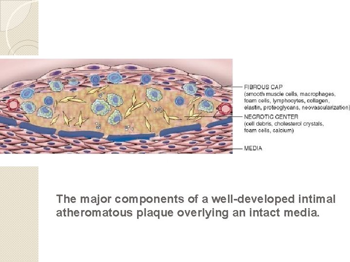 The major components of a well-developed intimal atheromatous plaque overlying an intact media. 