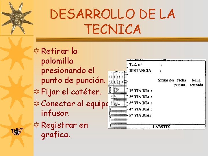 DESARROLLO DE LA TECNICA Y Retirar la palomilla presionando el punto de punción. Y