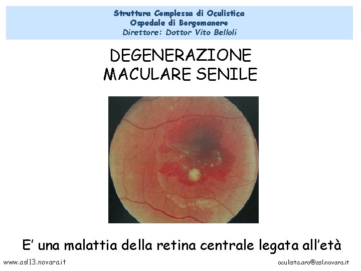 Struttura Complessa di Oculistica Ospedale di Borgomanero Direttore: Dottor Vito Belloli DEGENERAZIONE MACULARE SENILE