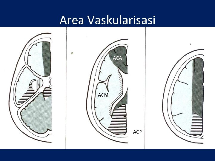 Area Vaskularisasi ACA ACM ACP 