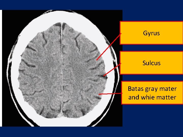 Gyrus Sulcus Batas gray mater and whie matter 