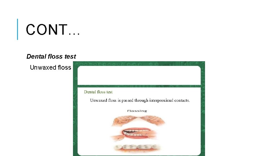 CONT… Dental floss test Unwaxed floss is passed through the interproximal contacts 