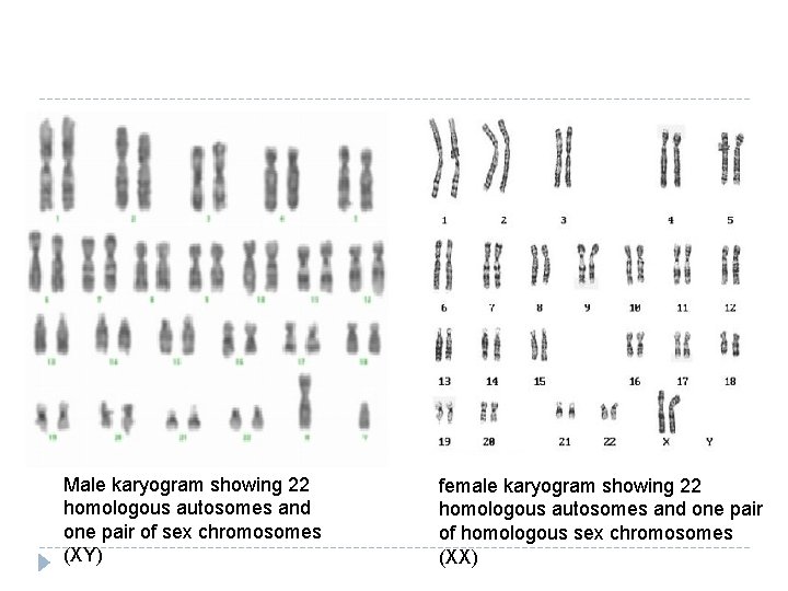 Male karyogram showing 22 homologous autosomes and one pair of sex chromosomes (XY) female