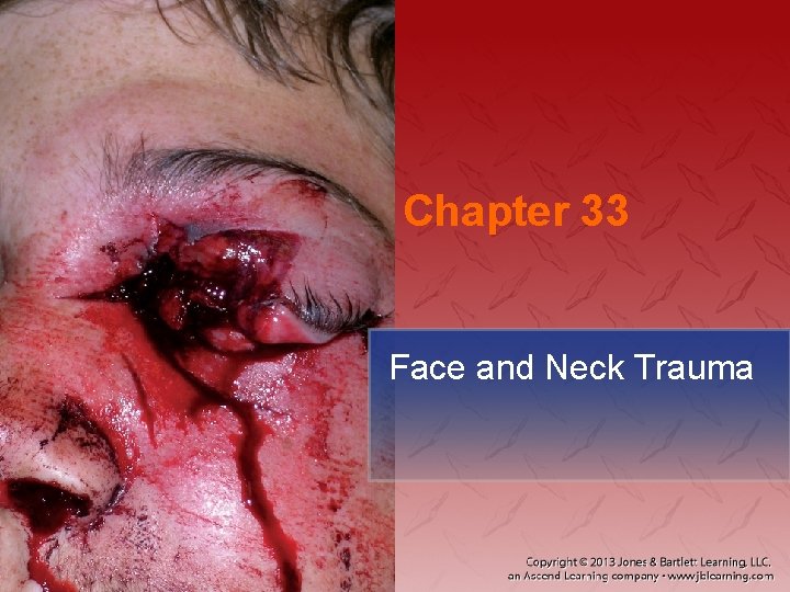 Chapter 33 Face and Neck Trauma 