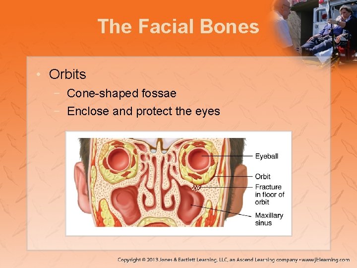 The Facial Bones • Orbits − Cone-shaped fossae − Enclose and protect the eyes