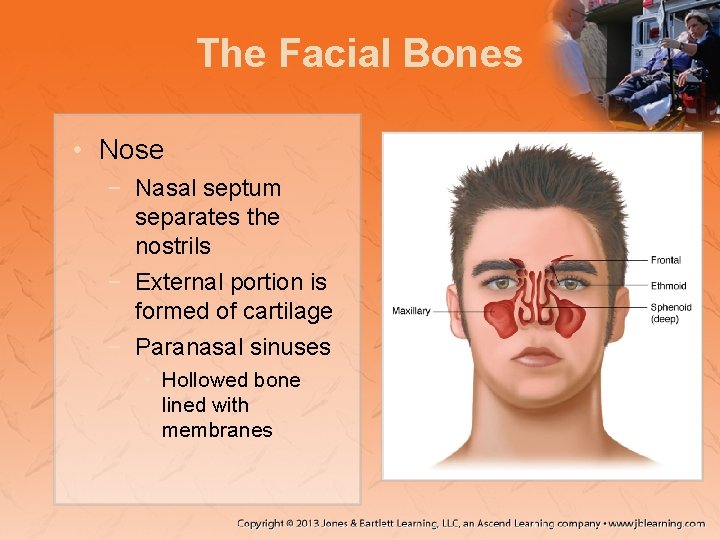 The Facial Bones • Nose − Nasal septum separates the nostrils − External portion