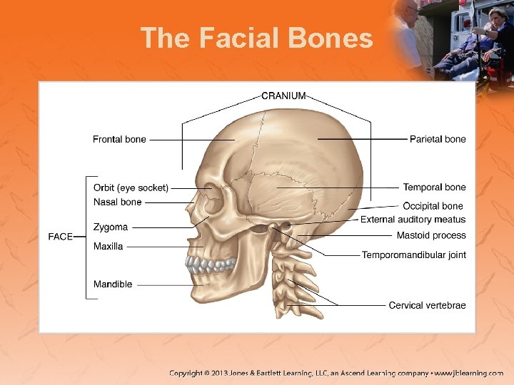 The Facial Bones 