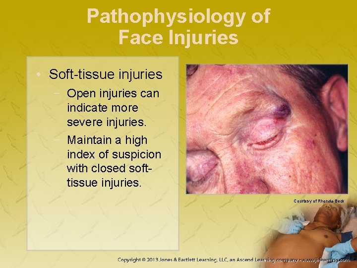 Pathophysiology of Face Injuries • Soft-tissue injuries − Open injuries can indicate more severe