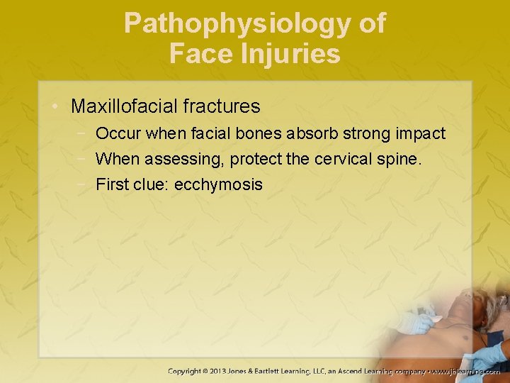 Pathophysiology of Face Injuries • Maxillofacial fractures − Occur when facial bones absorb strong