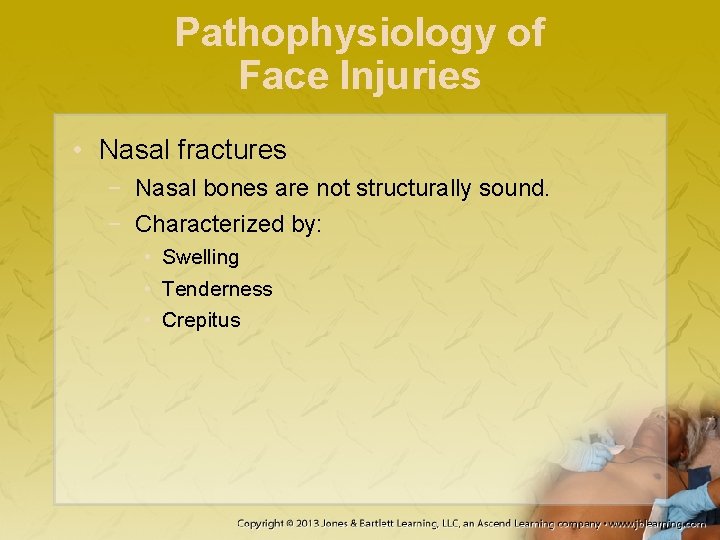 Pathophysiology of Face Injuries • Nasal fractures − Nasal bones are not structurally sound.