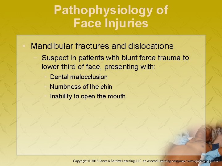 Pathophysiology of Face Injuries • Mandibular fractures and dislocations − Suspect in patients with