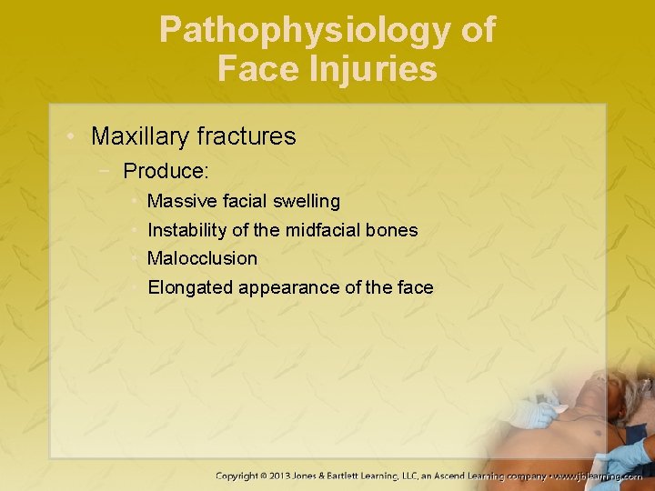 Pathophysiology of Face Injuries • Maxillary fractures − Produce: • • Massive facial swelling