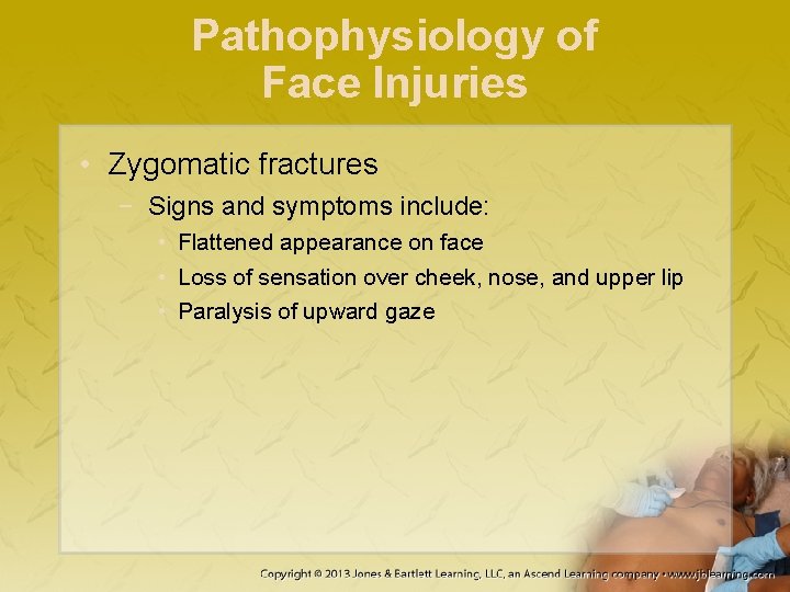 Pathophysiology of Face Injuries • Zygomatic fractures − Signs and symptoms include: • Flattened
