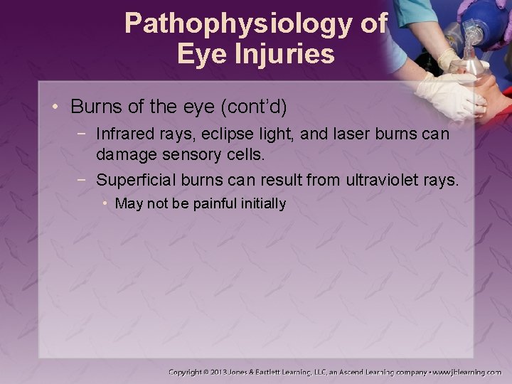 Pathophysiology of Eye Injuries • Burns of the eye (cont’d) − Infrared rays, eclipse