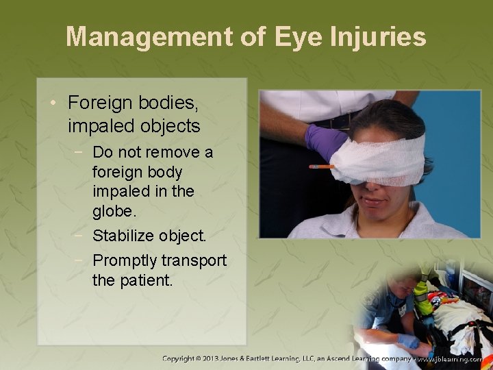 Management of Eye Injuries • Foreign bodies, impaled objects − Do not remove a